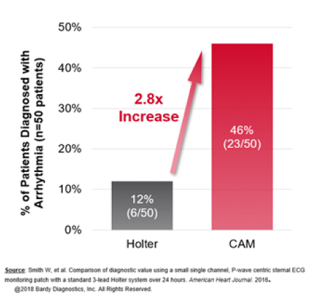 Chart showing study findings on the increase in the number of patients diagnosed with arrhythmia using CAM relative to using Holter